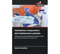 Valutazione comparativa dell'adattamento palatale: Valutazione comparativa dell'adattamento palatale nei palati poco profondi e profondi - Uno studio in vitro