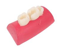 VANZACK Modello di Simulazione Radicolare per Riempimento, Plastico, | Anatomia Realistica, Facile da Pulire, Riutilizzabile, Supporto All'addestramento, per Studenti e Professionisti