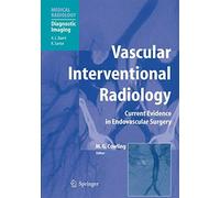 Vascular Interventional Radiology: Angioplasty, Stenting, Thrombolysis and Throm
