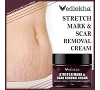 Vedlekha Crema Smagliature per Ridurre Smagliature e Cicatrici per Uomo e Donna