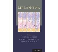 Vernon K. Sondak Melanoma (Tascabile)