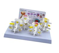 Vertebre Lombari Umane Modello Medicals Strumento di insegnamento Umano Lombare Colonna vertebrale Anatomia Modello Scuola Forniture didattiche Vertebre Spina Anatomia Strumento Medicali