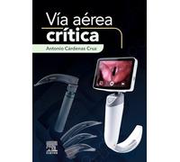 Vía aérea crítica