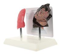 VICASKY Modello Anatomico del Polmone per Insegnamento, PVC Realistico | Uso Didattico per Anatomia e Fisiologia, Adatto a Studenti, Effetto Realistico, Modello Comparativo