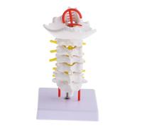 VILLFUL Modello Anatomico Colonna Cervicale con Arteria Carotidea Dettagliato e Didattico per Studi Medici e Formazione Ospedaliera con Supporto Espositivo Portatile