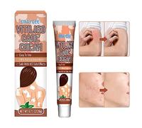 Vitiligine, crema vitiligine contro macchie bianche sulla pelle 20 g, crema rimozione vitiligine, crema rigenerante, riduce le macchie bianche e migliora la pigmentazione della pelle Odavom