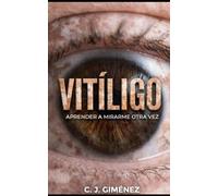 Vitíligo: Aprender a mirarme otra vez