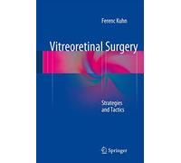 Vitreoretinal Surgery: Strategies and Tactics
