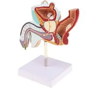 VUIKLCty Modello anatomico degli organi genitali Maschili Modello anatomico delle malattie urologiche Maschili for Strumenti didattici Medici
