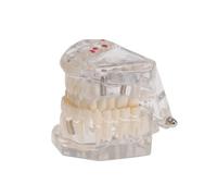 Warmhm Modello Dimostrativo Rimovibile per Studio Odontoiatrico, Modello di Orale Elementi Estraibili per Insegnamento e Pratica Clinica in Scuole di Odontoiatria