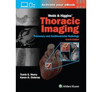 Webb & Higgins Thoracic Imaging: Print + eBook with Multimedia