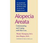 Wendy Thompson Jerry Shapiro Alopecia Areata (Tascabile)