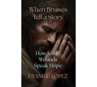 When Bruises Tell a Story: How Jesus’ Wounds Speak Hope