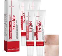 White Freckle Cream, Dark Spot Correcting Glow Serum, Dark Spot Corrector per il viso, Niacinamide Brighten Skin Tone, Anti Wrinkle Moisturizing (4 pezzi)