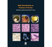 WHO Classification of Tumours of the Eye: WHO Classification of Tumours, Volume 12: Vol. 12