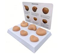 WHOOLEFUN Set di Modelli della Prostata con Patologie, Modello Anatomico per La Palpazione della Prostata, Strumento per L'addestramento alle Lesioni del Sistema Riproduttivo Maschile