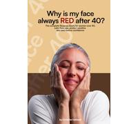 WHY IS MY FACE ALWAYS RED AFTER 40?: The Complete Guide to Understanding Rosacea, Calming Flare-Ups, and Restoring Healthy, Confident Skin