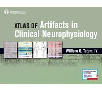 William O. Tatu Atlas of Artifacts in Clinical Neurophysiolog (Copertina rigida)