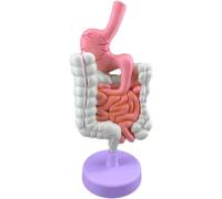 WLGDBXF Modello patologico dell'intestino crasso Modello didattico di Anatomia patologica Modello di Organo Umano per l'insegnamento agli Studenti delle Classi di Studio