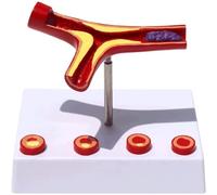 WLGDBXF Modello vascolare arterioso colorato Modello didattico di patologia Medica Modello di Organo Umano Arteriosclerosi cardiovascolare