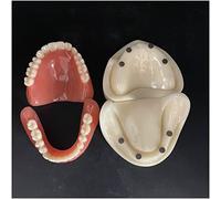 WOTZOV Modello didattico di impianti dentali - Modello di Protesi dentaria ad adsorbimento a Bocca Intera con 4 impianti dimostrativi - Modello didattico di dentistica