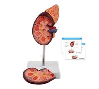 WULTNICEW Modello di Rene, Modello Anatomico Umano in PVC a 2 Parti, con Ghiandole Surrenali, Arteria e Vena Renale, inclusa Scheda Manuale Prodotto per Formazione ed Educazione Medica