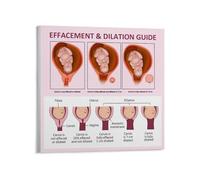 WVPJJNXAFN Clinical Cervical Dilation Procedures Poster, Medical Reference Guide Canvas Print Wall Art for Healthcare Professionals(Unframed,12x18inch(30x45cm))