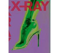 X-RAY: The Power of Röntgen Vision