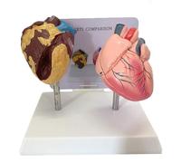 XCGDNVRDP Modello di Cuore anatomico di organi Umani, Modello di confronto tra Cuore Fumatore e Cuore Normale, Modello di Cuore anatomico di organi Umani for Studio Medico e visualizzazione didattica