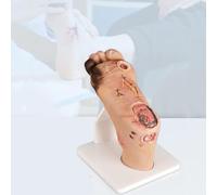 XCSCUK Modello del piede diabetico, lesioni purulente delle ferite lievi/gravi, strumenti di presentazione per anatomia, fisiologia, cura delle ferite (grave)