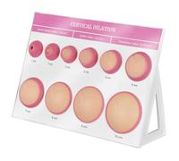 XCSCUK Simulatore di dilatazione cervicale, simulatore di dilatazione cervicale a 10 Fasi per Donne in Gravidanza, per educazione al Parto, Formazione per ostetriche