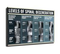 XGINERFEX Spinal Degeneration Chart Poster Canvas Print Chiropractic Educational Wall-Art for Office Clinic Waiting Room(Unframed,16X24inch(40X60cm))