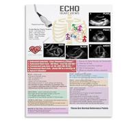XGINERFEX Ultrasound Heart Views Poster Echocardiogram Pattern Reference Guide for Sonography Students and Clinical Practice(Unframed,16x24inch(40x60cm))