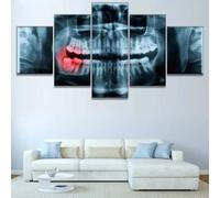 XIAOLZSL Tela Wall Art Immagine 5 Pezzi Quadro su Tela Stampa Dentista Denti Xray Artistica Moderno Canvas Home Decor Regalo Appendiabiti da Parete Incorniciato 150×80cm
