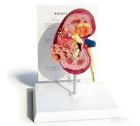 Xiaoxu Modello anatomico del Rene, Modelli di Rene Normali e patologici a grandezza Naturale per l'apprendimento Medico, Replica dell'anatomia Umana del Rene per Lo Studio Medico, Strumento didattico