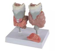 Xiaoxu Modello anatomico della tiroide per la Formazione Medica, Modello di Organo endocrino per la dimostrazione di patologie, Strumento di apprendimento anatomico, risorsa educativa per la Salute.