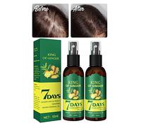 XIRUJNFD Shouga Kingu Hair Growth Oil, King of Ginger 7 Days Hair Growth, Shougagro Japanese Hair Growth Spray, Ginger Oil for Hair Growth, Anti-Hair Loss Oil (2Pcs)
