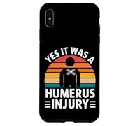 Yes It Was A Humerus Injury Broken Arm Recovery - Custodia per iPhone XS Max