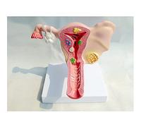 YHNNH, Uterino e ovaie Organo genitale femminile Modello anatomico femminile Ginecologia Modello di ovaie e utero for l'educazione medica