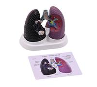 YiNLuax Modello polmonare patologico anatomico modello normale e patologico di anatomia polmonare per l'insegnamento della ricerca clinica