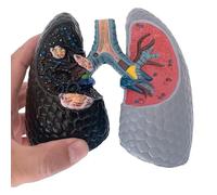 YIYIRAN Modello di confronto tra polmoni Umani e Fumatori, Modello broncopolmonare Umano, visualizzazione dell'anatomia polmonare, Struttura per Gli Effetti del Fumo sulla Salute polmonare
