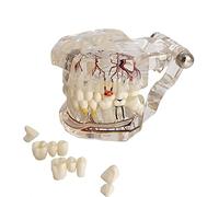 YOUYA DENTAL Modello dentale di riparazione neurale Modello dentale Malattia dell'impianto Modello dei denti Dentista Modello di insegnamento patologico standard dei denti rimovibili