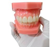 YRQMGSF Modelli Dentali, Modello di Trattamento Ortodontico Invisibile, Modello Ortodontico, Modello di Dente per Studio, Insegnamento e Esposizione Educativa