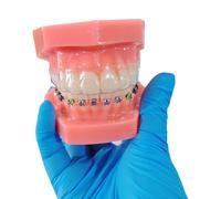 YRQMGSF Modelli Dentali, Modello di Trattamento Ortodontico Invisibile, Modello Ortodontico, Modello di Dente per Studio, Insegnamento e Esposizione Educativa