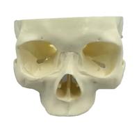 YRQMGSF Modello Dentale e Maxillofacciale per la Perforazione delle Ossa Zigomatiche e Pterigoidee e Il Sollevamento degli Impianti per l'Educazione del Paziente