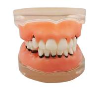 YRQMGSF Modello Dentale Trasparente per la parodontopatia Malattia parodontale Studio Dentale Modello di calcolo raschiante dei Denti