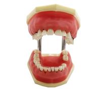 YRQMGSF Modello Dentale Trasparente per la parodontopatia Malattia parodontale Studio Dentale Modello di calcolo raschiante dei Denti