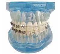 YRQMGSF Modello di confronto del Vassoio Dentale - Confronto del Modello didattico metà Metallo e metà Ceramica - per l'educazione e Le dimostrazioni odontoiatriche
