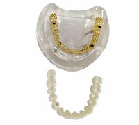 YRQMGSF Modello di Ponte Dentale Modello di Denti dentali Modello di restauro implantare Typodont Dentista Insegnare Studiare