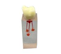 YRQMGSF Modello di Radice Dentale Modello per Esercitazioni sul Canale Radicolare Dentale Modello di Denti Typhoon per Insegnamento e Studio